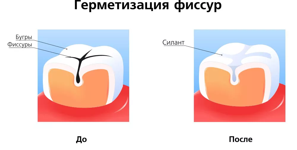 60e902c8186fcc0f769efa04b154b78d.jpg